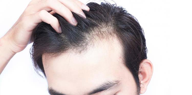 treatment for hair loss san antonio